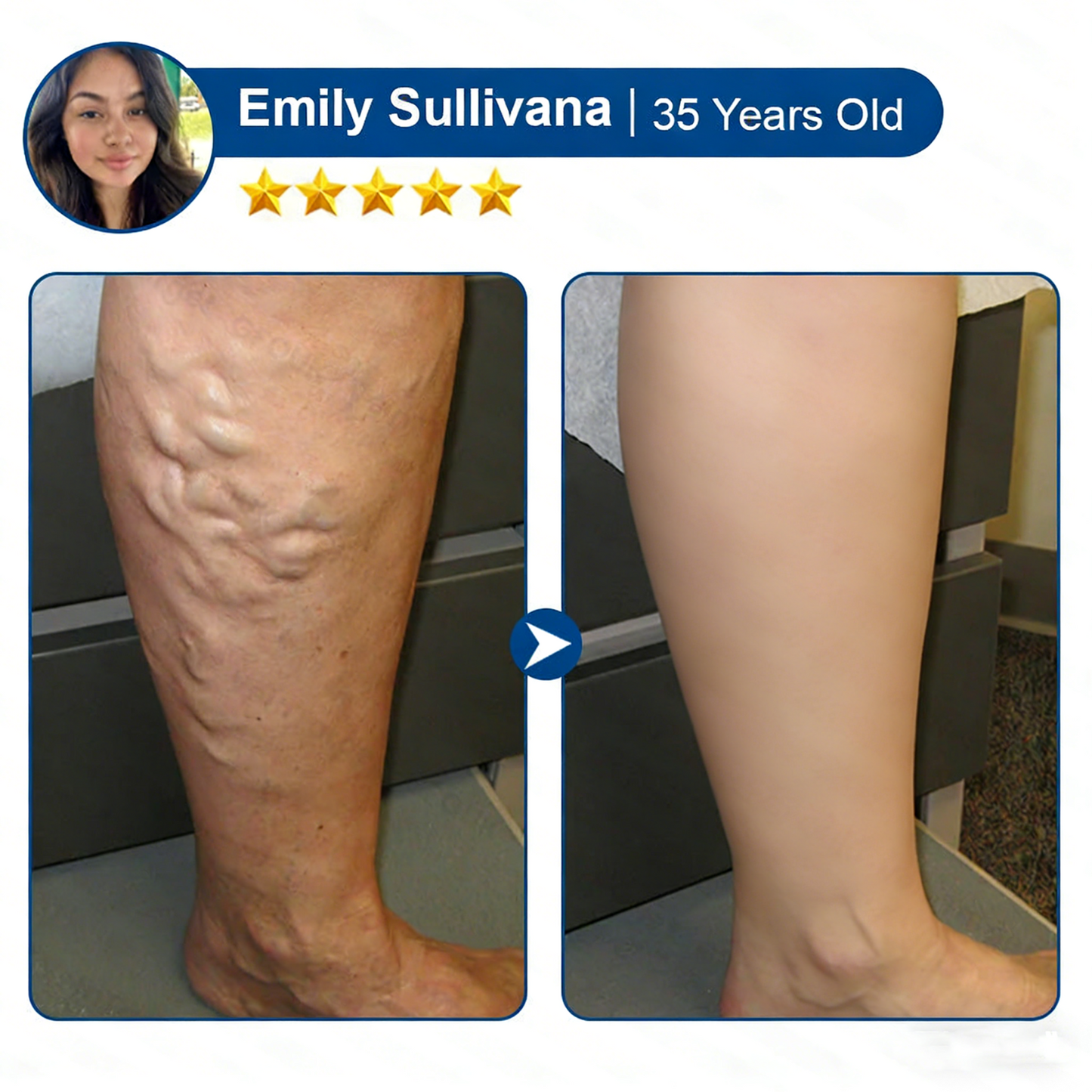 KLENIMOREยฎ ๐ฝ๐ฒ๐ถ๐ฃ ๐พ๐จ๐ง๐๐ผ๐ช๐ง ๐๐๐๐ซ๐๐๐๐ฒ๐ฑ๐น๐ ๐๐๐ญ๐๐ ๐๐๐๐ต ๐๐๐ซ๐๐ฃ๐๐๐ ๐๐๐๐๐บ๐๐ง & ๐ฏ๐๐๐ฝ๐ฒ๐ง๐๐๐๐ง ๐๐๐๐๐๐ฒ๐ฟ๐ฎ๐ฟ๐-๐๐๐ฒ ๐๐ข๐ฌ๐ข๐๐ฅ๐ ๐๐๐ฌ๐ฎ๐ฅ๐ญ๐ฌ ๐๐จ๐ซ ๐๐๐ซ๐ข๐๐จ๐ฌ๐ ๐๐๐ข๐ง๐ฌ