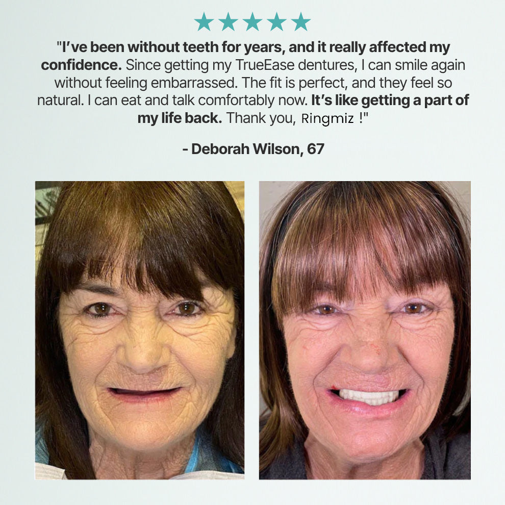 Ends Today: 70% OFF! Ringmiz? Custom-Fit Full Functional DenturesMake you more confident