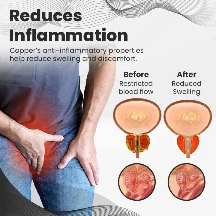 【 ✨Official Brand Store ✨】Ringmiz Copper Mag Prostate Therapy Ring（Limited Time Discount 🔥 Last Day）