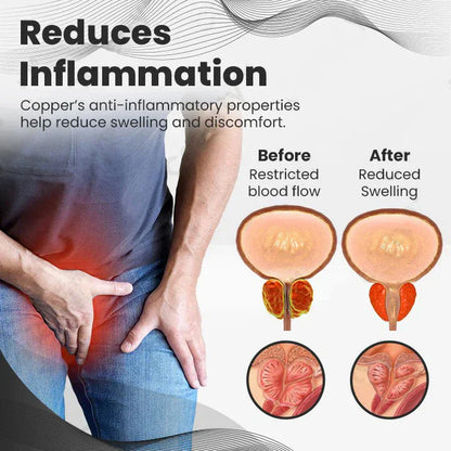 【 ✨Official Brand Store ✨】Ringmiz Copper Mag Prostate Therapy Ring（Limited Time Discount 🔥 Last Day）