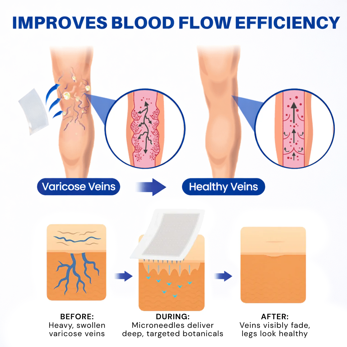 KLENIMORE® 𝑽𝗲𝗶𝙣 𝘾𝐨𝐧𝘁𝗼𝙪𝙧 𝙈𝙞𝐜𝐫𝒐𝒏𝒆𝗲𝗱𝗹𝙚 𝙋𝙖𝐭𝐜𝒉 𝒘𝒊𝘁𝗵 𝗔𝙙𝙫𝙖𝙣𝙘𝐞𝐝 𝐃𝒊𝒐𝒔𝗺𝙞𝐧 & 𝑯𝒆𝘀𝗽𝗲𝙧𝙞𝙙𝙞𝐧 𝐃𝒆𝒍𝒊𝒗𝗲𝗿𝙮🌿𝟕-𝐃𝐚𝐲 𝐕𝐢𝐬𝐢𝐛𝐥𝐞 𝐑𝐞𝐬𝐮𝐥𝐭𝐬 𝐟𝐨𝐫 𝐕𝐚𝐫𝐢𝐜𝐨𝐬𝐞 𝐕𝐞𝐢𝐧𝐬